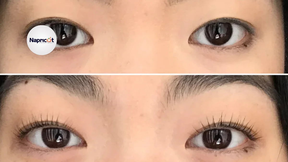 How do I straighten my crooked eyelashes? - 5 Methods That Actually Work