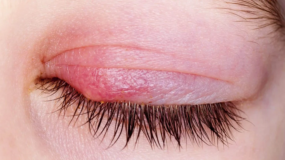 how to clean eyelash