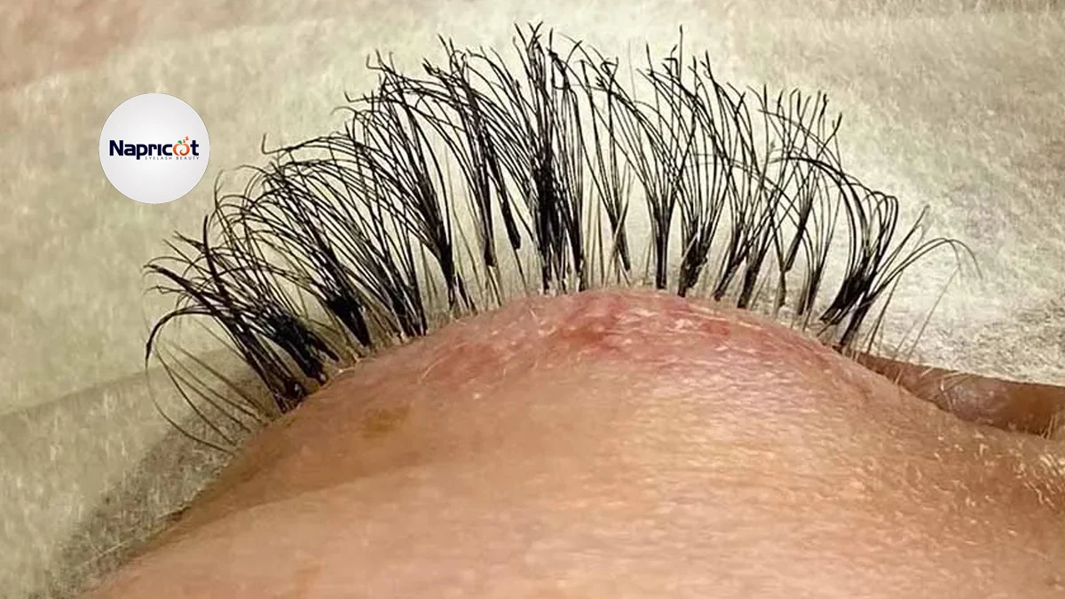 How to Fix Burnt Eyelashes? 5 Steps To Keep In Mind