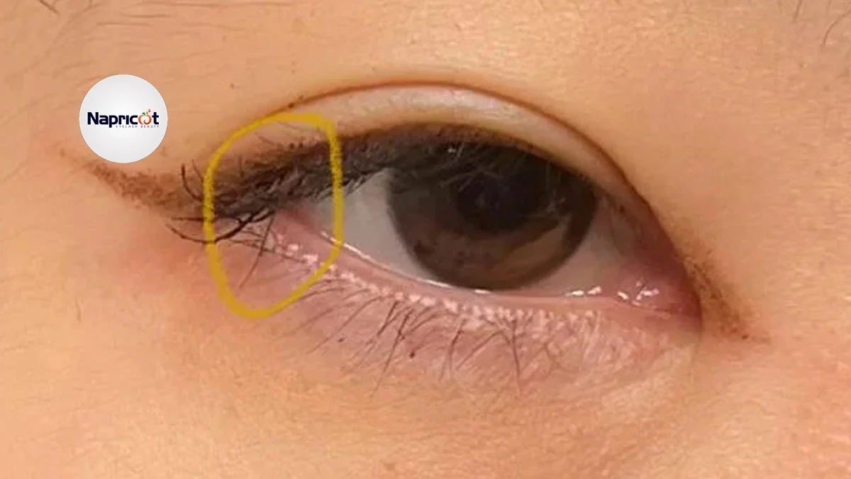 How To Fix Eyelash Cowlick? 3 Simple Steps