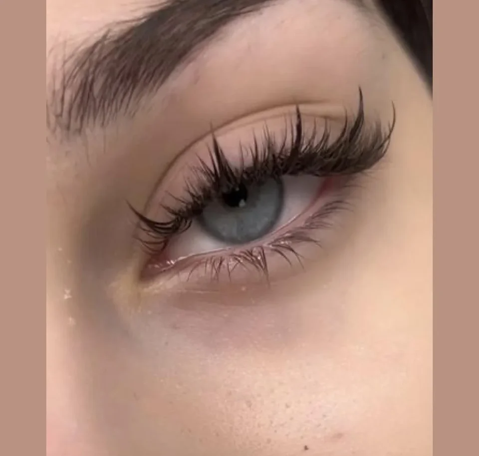 eyelash Blindness