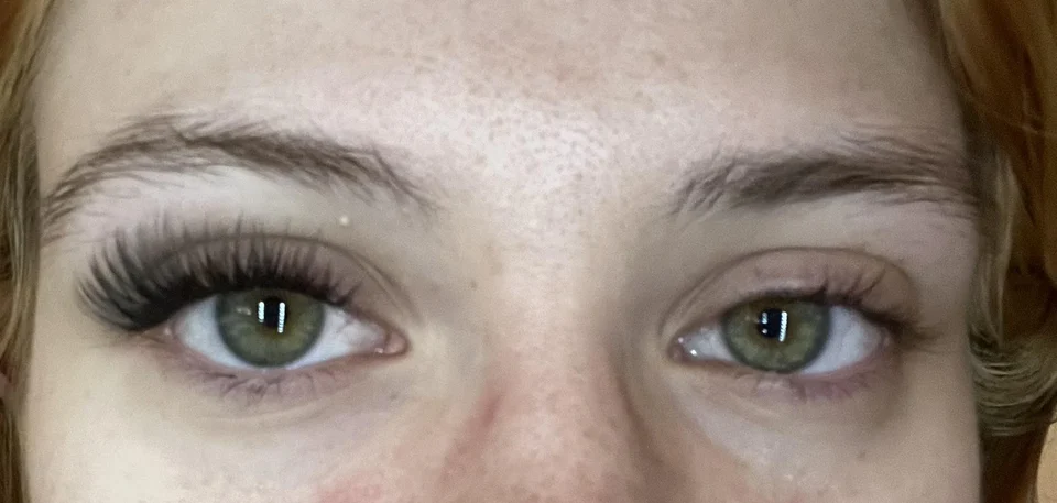 ocular surface irritation