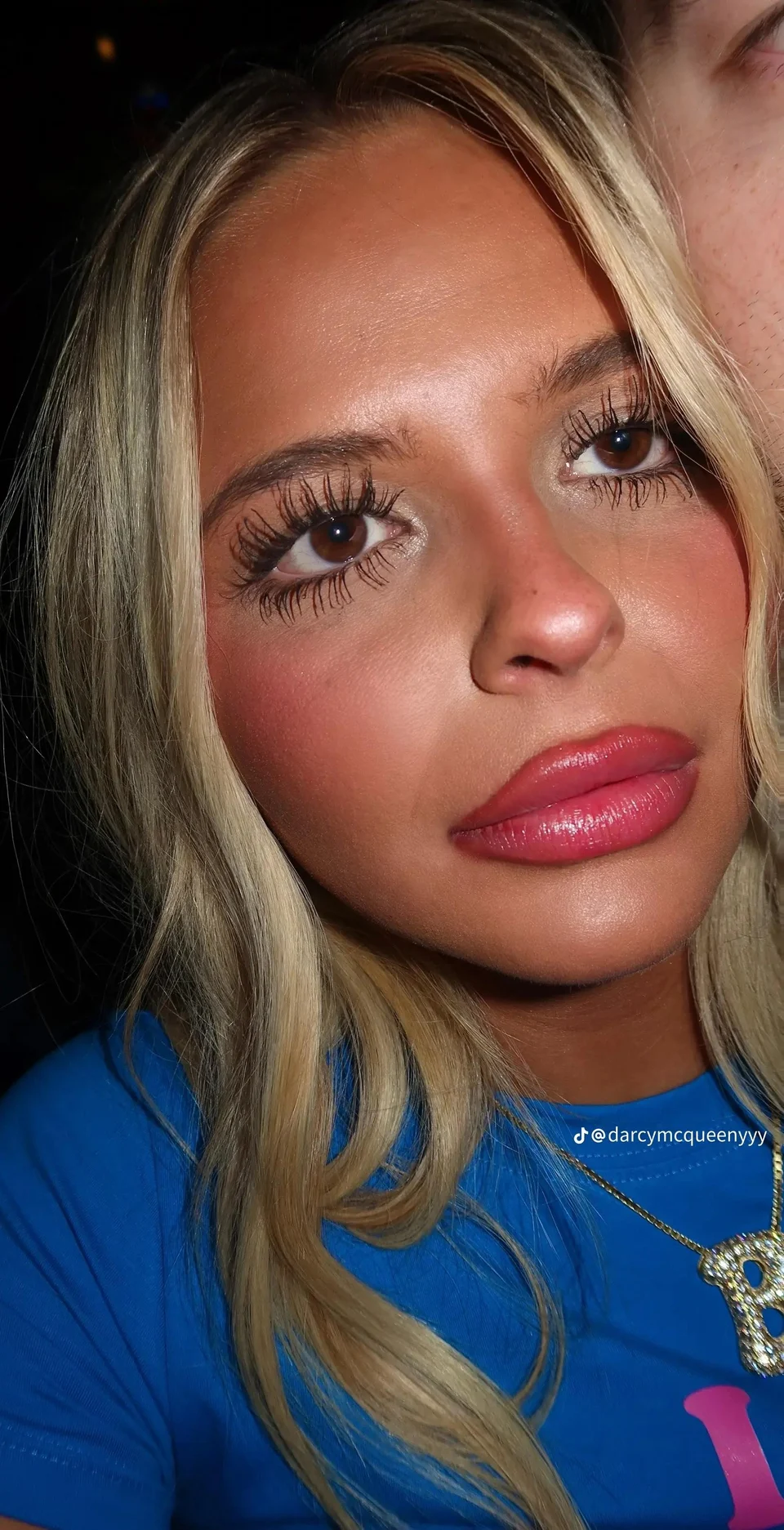 eyelash extension side effects